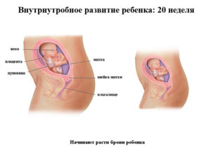 Беременность 20 неделя расположение ребенка в матке