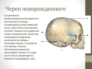 Мягкие кости черепа у новорожденных