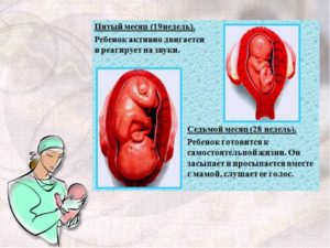 Плод очень активно двигается