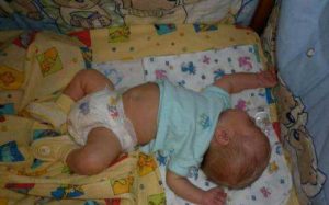 Ребенок выгибается дугой когда спит