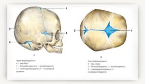 Мягкие кости черепа у новорожденных