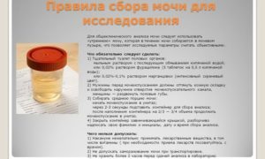 Перед сдачей анализа мочи что нельзя есть