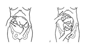 Упражнения для поворота плода в головное предлежание