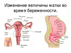 Напряженная матка при беременности