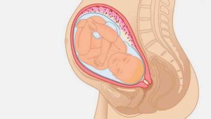 Постоянный тонус матки на 39 неделе беременности