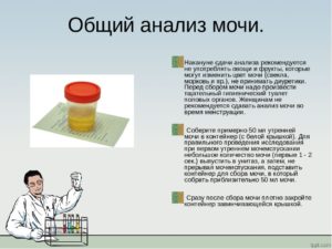 Можно ли есть яблоки перед сдачей мочи