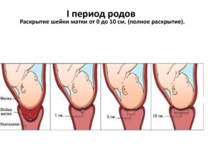 На сколько см должна открыться матка при родах