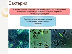 Бактерии в моче незначительное количество при беременности