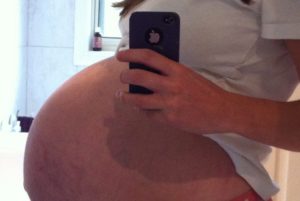 39 неделя беременности болит живот и каменеет живот