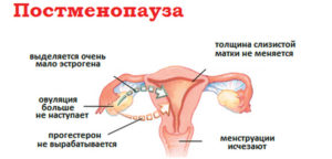 При климаксе размеры матки