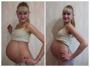 Тянет низ живота при беременности на 38 неделе
