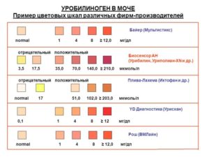 В моче следы уробилиногена