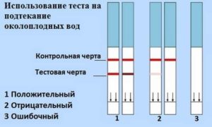 Причины подтекания околоплодных вод в третьем триместре