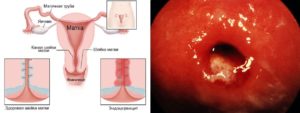 Мягкая матка при осмотре что это значит