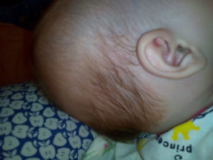 Голова у новорожденного потеет голова