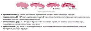 Степень зрелости легких плода по неделям норма таблица