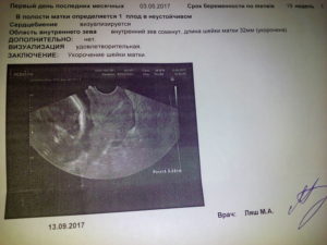 Шейка матки 29 мм при беременности 29 недель