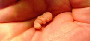 7 эмбриональная неделя беременности