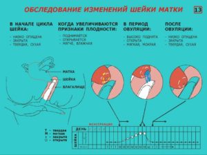 Мягкая матка при осмотре что это значит