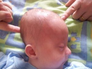 Голова у младенца большая голова
