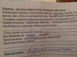 Локализация хориона по передней стенке что это значит