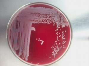 При беременности escherichia coli