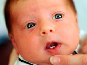 Почему дети рождаются с зубами