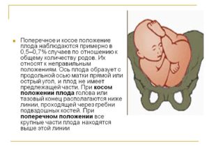 Поперечное положение плода в 32 недели форум