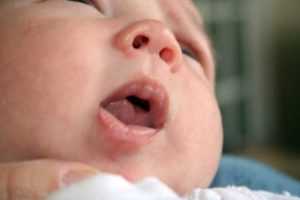 Волдыри у новорожденных на губах