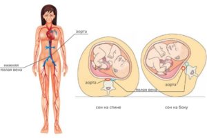Почему во время беременности нельзя лежать на спине