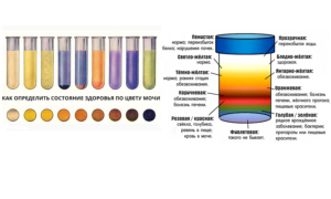 Какого цвета моча у беременных на ранних сроках