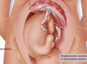 36 неделя беременности боли внизу живота