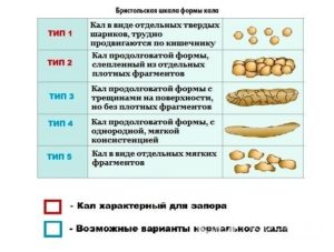 Твердый стул у ребенка 1 год