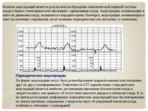 Акцелерации на ктг норма