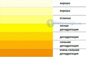 Моча сильно желтая у ребенка