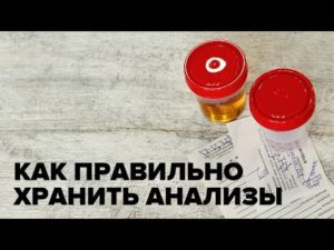 Можно ли перед анализом ставить мочу в холодильник