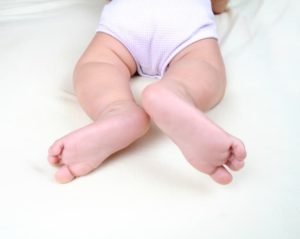 Слабые мышцы у ребенка ног