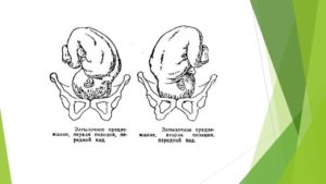 Продольное положение головное предлежание 1 позиция передний вид
