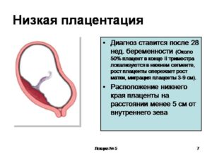 Может ли опуститься плацента