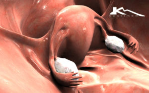 Инволютивные изменения матки и яичников что это такое