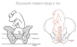 Головка опустилась в таз когда роды у повторнородящих