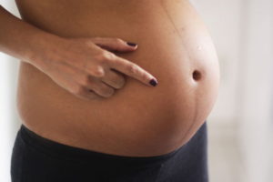 При беременности на животе нет полоски