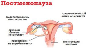 Год не было месячных при климаксе и начались