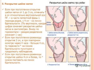 Можно ли почувствовать раскрытие шейки матки перед родами