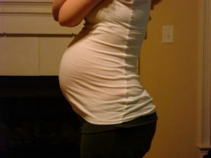 Беременность 20 недель двойней