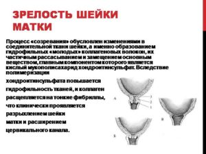 Что значит что шейка матки готова к родам