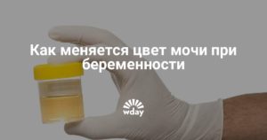 Какая цветом моча при беременности на ранних сроках