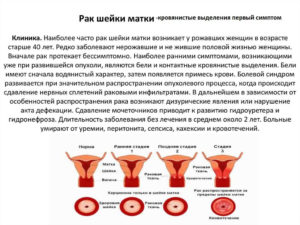 Кровянистые выделения после климакса в 60 лет причины