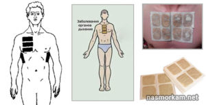 Можно ли беременным горчичники ставить на грудную клетку