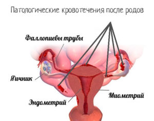 Начались кровянистые выделения через месяц после родов